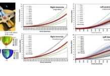 Пермский Политех открыл связь свойств ткани желудочков и риска сердечных патологий permskij politeh otkryl svyaz svojstv tkani zheludochkov i riska serdechnyh patologij-todey-ru-0