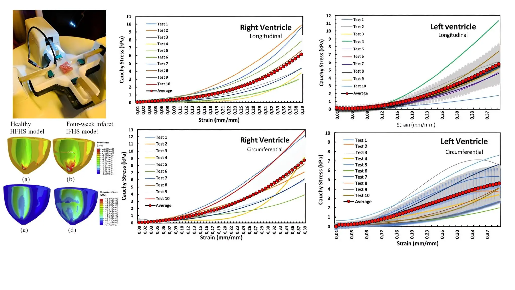 Пермский Политех открыл связь свойств ткани желудочков и риска сердечных патологий-0