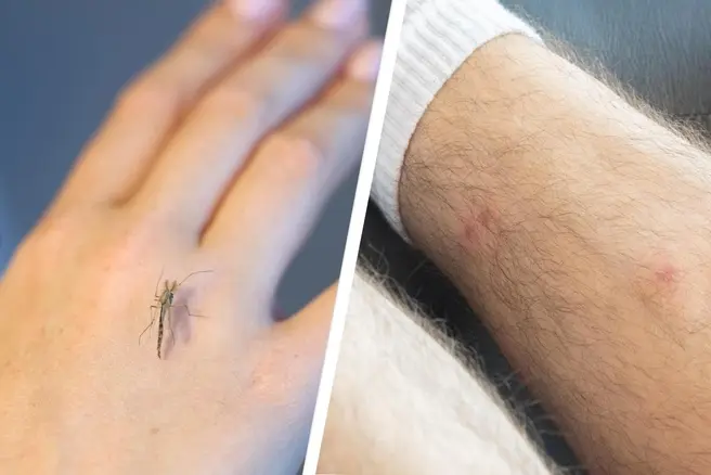 Не занимайтесь самолечением при сильном дискомфорте | Источник: Владислав Лоншаков / E1.RU, Дмитрий Толстошеев / MSK1.RU