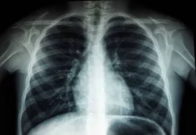 Российские ученые впервые описали три мутации BMPR2 при ИЛАГ rossijskie uchenye vpervye opisali tri mutaczii 2 pri ilag-todey-ru-0