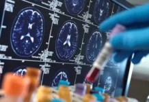 Сеченовский университет исследует HSP70 в борьбе с Альцгеймером и Паркинсоном sechenovskij universitet issleduet 70 v borbe s alczgejmerom i parkinsonom-todey-ru-0