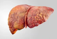 224 demonstriruet effektivnost v lechenii ozhireniya pecheni pri -todey-ru-0