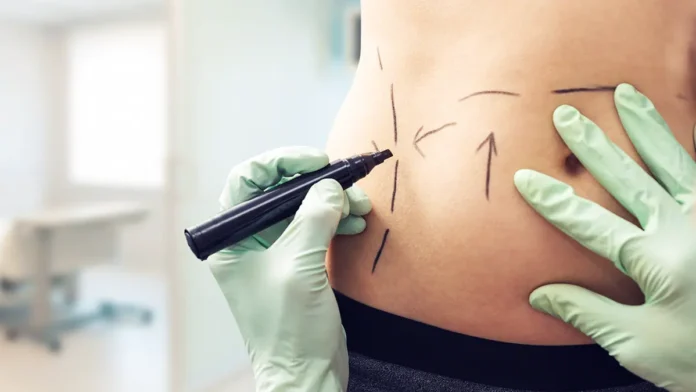evgenij prohoda i eksperty vyskazali mnenie o mammoplastike i rinoplastike osenyu-todey-ru-0