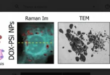 metodika mgu imeni mv lomonosova ispolzuet nanokontejnery dlya dostavki doksorubiczina v lechenii raka-todey-ru-0