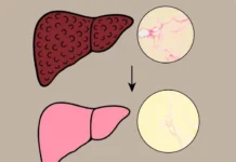 Университет Метрополитен в Осаке открывает исследование Lawsonia inermis и Lawsone против фиброза печени universitet metropoliten v osake otkryvaet issledovanie i protiv fibroza pecheni-todey-ru-0