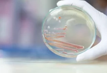 Новокузнецк борется с Serratia marcescens: защита новорожденных novokuzneczk boretsya s zashhita novorozhdennyh-todey-ru-0