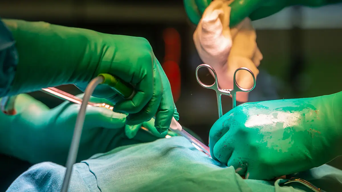 Бывшему защитнику «Шинника» Загре ампутировали ногу