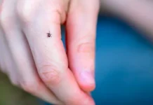 polyakova i trush podelilis merami zashhity ot kleshhej-todey-ru-0