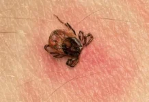 tomas russo rasskazal kak ne propustit bolezn lajma i alfagal-todey-ru-0