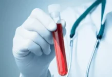 psatest nitu misis i mgu  proryv v vyyavlenii opuholej prostaty-todey-ru-0