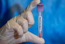 rospotrebnadzor hantavirus i glps v rossii pod kontrolem-todey-ru-0