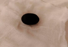 Успешная операция: приморские врачи извлекли гигантский камень из кишечника пациента 2b5d2a0b-0b2f-469b-928f-27f768b659e2-674dc6f9