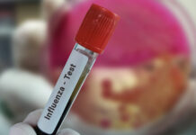 Роспотребнадзор прокомментировал случаи микоплазменной инфекции в столичном регионе rospotrebnadzor prokommentiroval sluchai mikoplazmennoj infekczii v stolichnom regione-obzone-su-174344139300-0