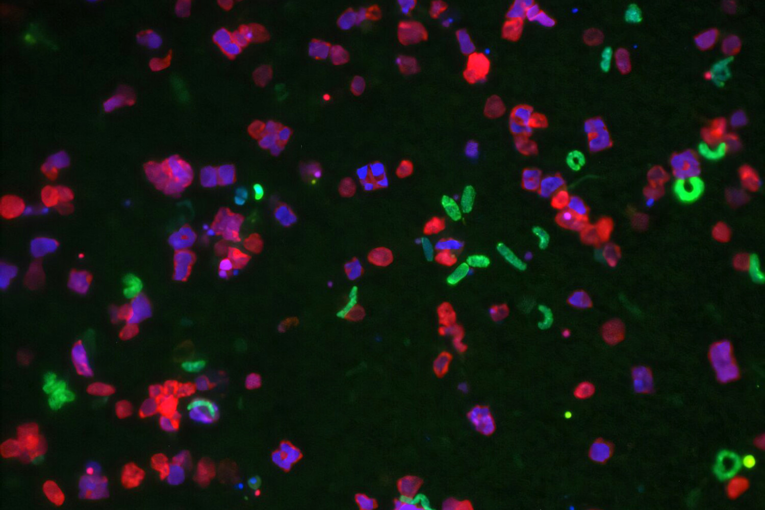 Озеро Шармуцельзее и LakeLab открыли тайну роста токсичных водорослей-0