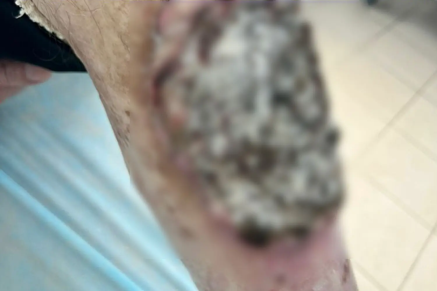 Сергей и Алтайский онкоцентр подчеркивают важность своевременной помощи-0