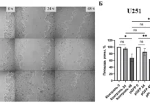 БФУ и МГУ обнаружили механизм агрессивности глиом и нейробластомы bfu i mgu obnaruzhili mehanizm agressivnosti gliom i nejroblastomy-obzone-su-0