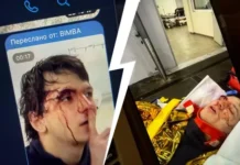 skandal na vecherinke anastasii ivleevoj i pravda o reanimaczii -obzone-su-0