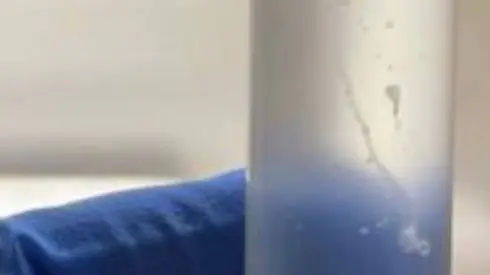 Врачи нашли червя в глазу у жительницы Омска