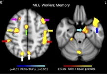 Институт динамики восприятия объясняет, как PATH помогает при сотрясении institut dinamiki vospriyatiya obyasnyaet kak pomogaet pri sotryasenii-obzone-su-0
