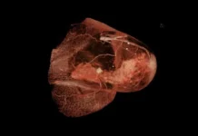 issledovanie mfti o kletochnyh liderah i nanochasticzah v metastazah raka-obzone-su-0