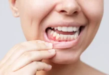 Ольга Харламова из STOMTECH PRO и Владимир Садовский советуют беречь здоровье дёсен olga harlamova iz i vladimir sadovskij sovetuyut berech zdorove dyosen-obzone-su-0