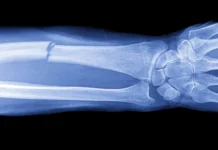 ПНИПУ раскрывает идеальную структуру имплантата для быстрого восстановления костной ткани pnipu raskryvaet idealnuyu strukturu implantata dlya bystrogo vosstanovleniya kostnoj tkani-obzone-su-0