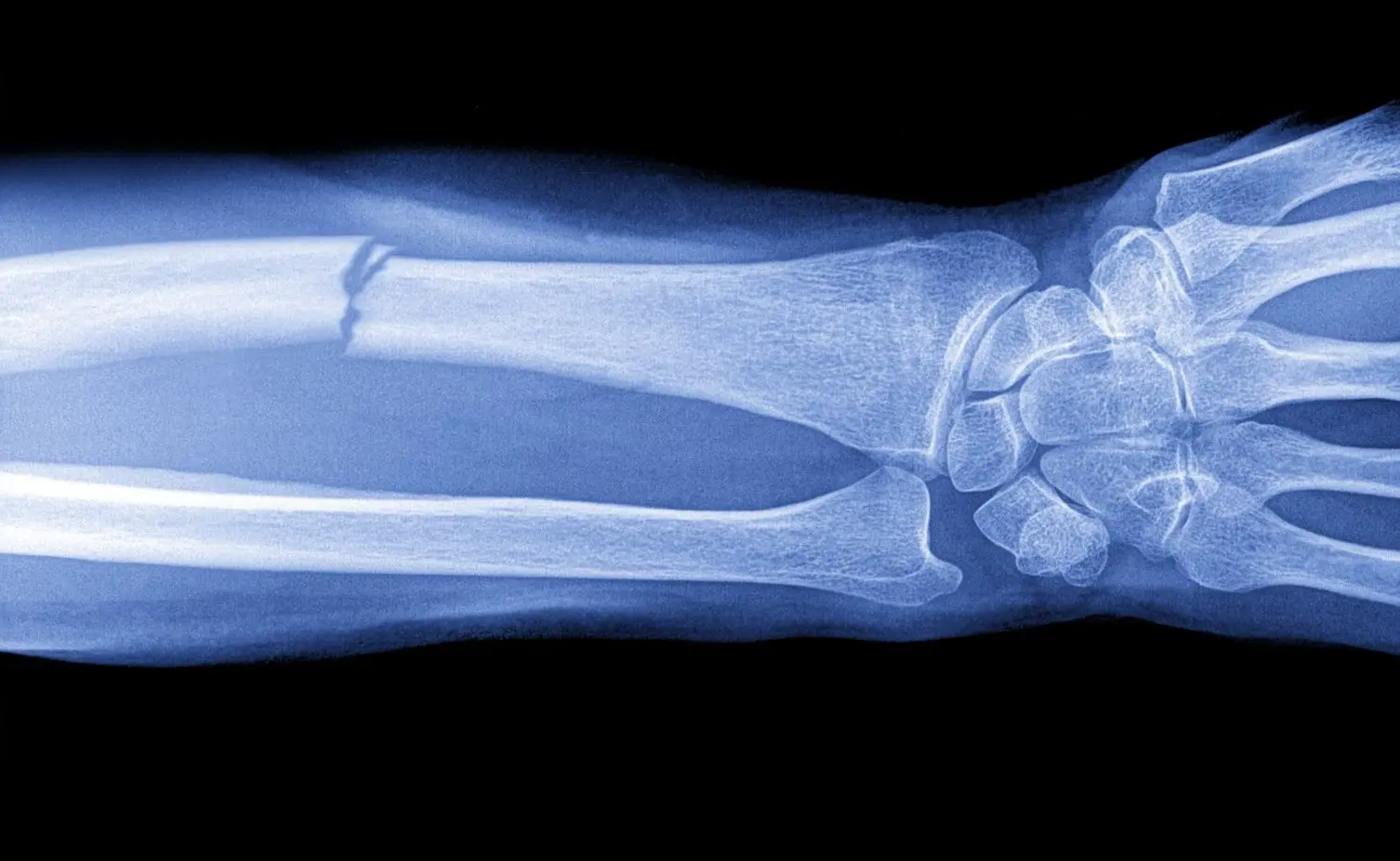 ПНИПУ раскрывает идеальную структуру имплантата для быстрого восстановления костной ткани-0