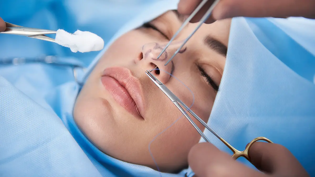 Популярные мифы о ринопластике