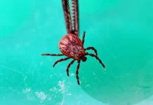 Наталья Пшеничная о безопасном способе удаления клеща natalya pshenichnaya o bezopasnom sposobe udaleniya kleshha-obzone-su-0