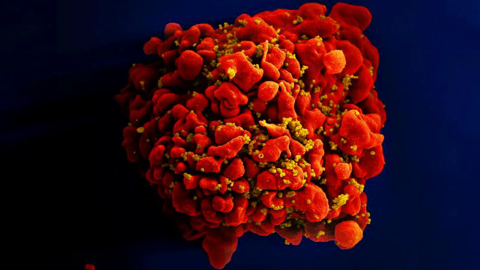 Минздрав РФ: стратегия привела к рекордно низкой заболеваемости ВИЧ-0