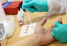 varivoda moskalev govoryat o diagnostike krovi i zdorove-obzone-su-0