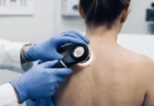 melanoma v sverdlovskoj oblasti  novye uspehi i zabota o zdorove-obzone-su-0