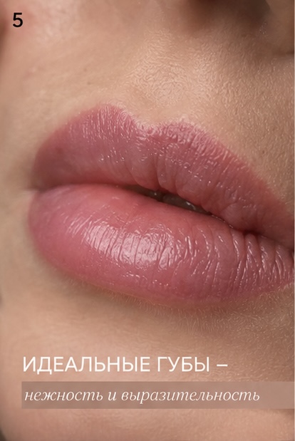 Reference image 1