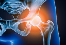 Важно знать: последствия и профилактика перелома шейки бедра 3adbc794-9766-4aa6-810c-a9f698138240-67741ce6