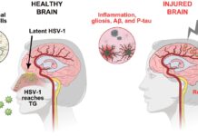 Прорыв в исследовании болезни Альцгеймера раскрыл связь травм головы с вирусом герпеса 0c867fa3-9782-4f2c-bcb6-d3f30e63146a-67d9755f
