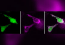 Революционное открытие: биолюминесцентные маркеры РНК открывают новую эру в исследовании человеческого организма 910ae179-8f8b-4acc-ab91-d1e8346f9297-67d4462f