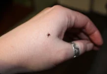 Росгосстрах рекомендует защиту от клещей в регионах России rosgosstrah rekomenduet zashhitu ot kleshhej v regionah rossii-uralnovosti-ru-174195509300-0