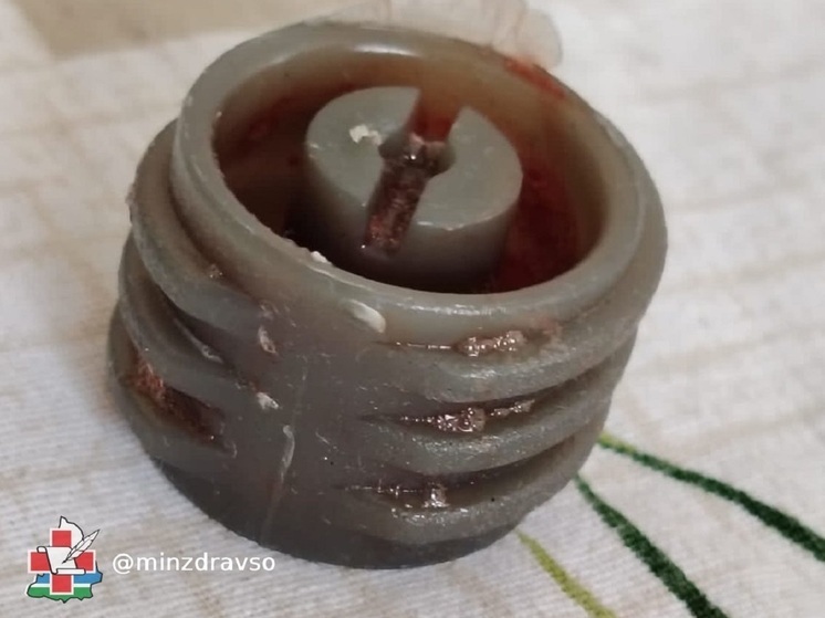 На Урале из гортани полуторагодовалого ребенка вытащили шайбу