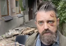 Обрушение балкона в Киеве вызвало экстренный пост в Instagram и реакцию Виталия Кличко obrushenie balkona v kieve vyzvalo ekstrennyj post v i reakcziyu vitaliya klichko-uralnovosti-ru-174852889400-0