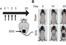 Национальный университет Тайваня сообщает о роли кислот в лечении облысения naczionalnyj universitet tajvanya soobshhaet o roli kislot v lechenii oblyseniya-uralnovosti-ru-0