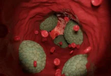 universitet makmastera sdelal vazhnoe otkrytie o skrytom zhire i zdorove arterij-uralnovosti-ru-0