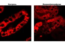 Антиоксидант SkQR1 из МГУ имени М.В. Ломоносова поможет в борьбе с сепсисом и почечной недостаточностью у детей antioksidant 1 iz mgu imeni mv lomonosova pomozhet v borbe s sepsisom i pochechnoj nedostatochnostyu u detej-uralnovosti-ru-0
