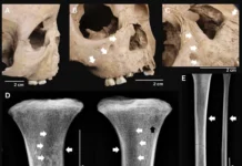 Археологи во Вьетнаме раскрыли тайны древних инфекций и трепонематозов arheologi vo vetname raskryli tajny drevnih infekczij i treponematozov-uralnovosti-ru-0