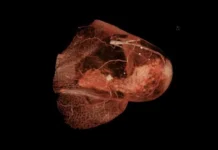 Инновационные Т-клетки и Сеченовский Университет: будущее HER2-рака innovaczionnye tkletki i sechenovskij universitet budushhee 2raka-uralnovosti-ru-0