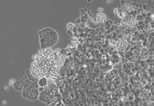 razvitie biotehnologij dlya chistoj vody v kazani i innopolise-uralnovosti-ru-0