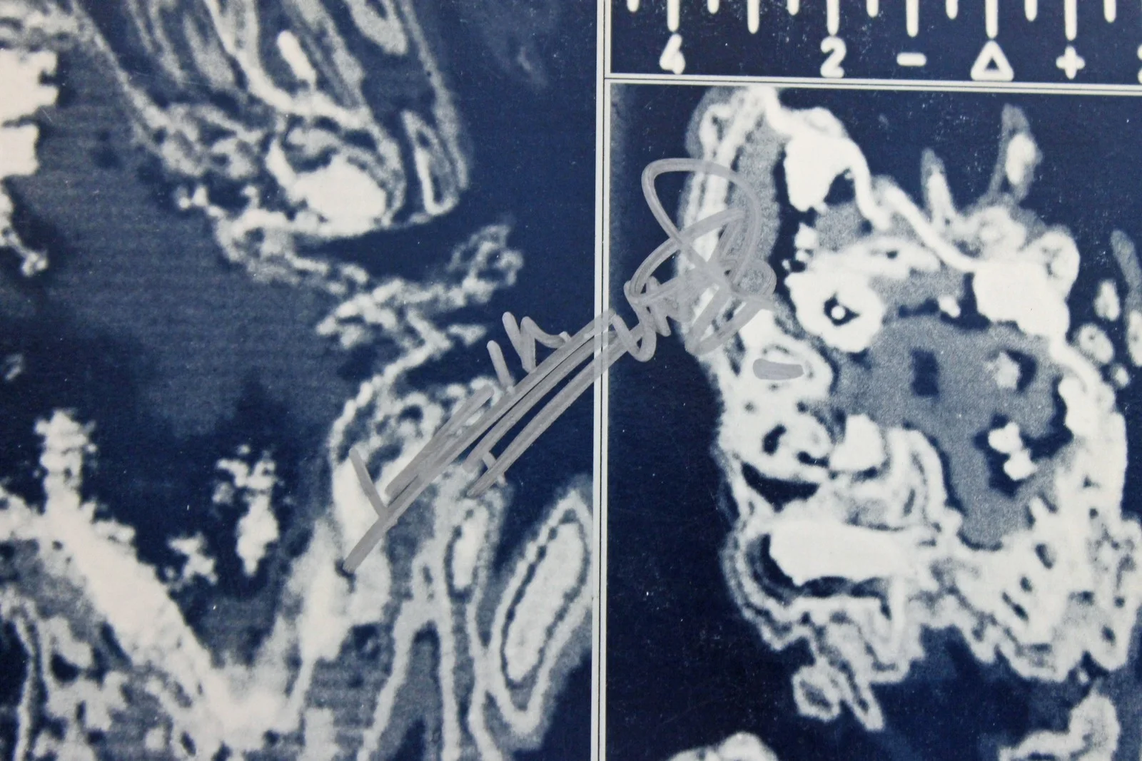 Keith Richards — Keith Richards Rolling Stones Signed 'Emotional Rescue' Album Cover PSA #AB04434, image 2