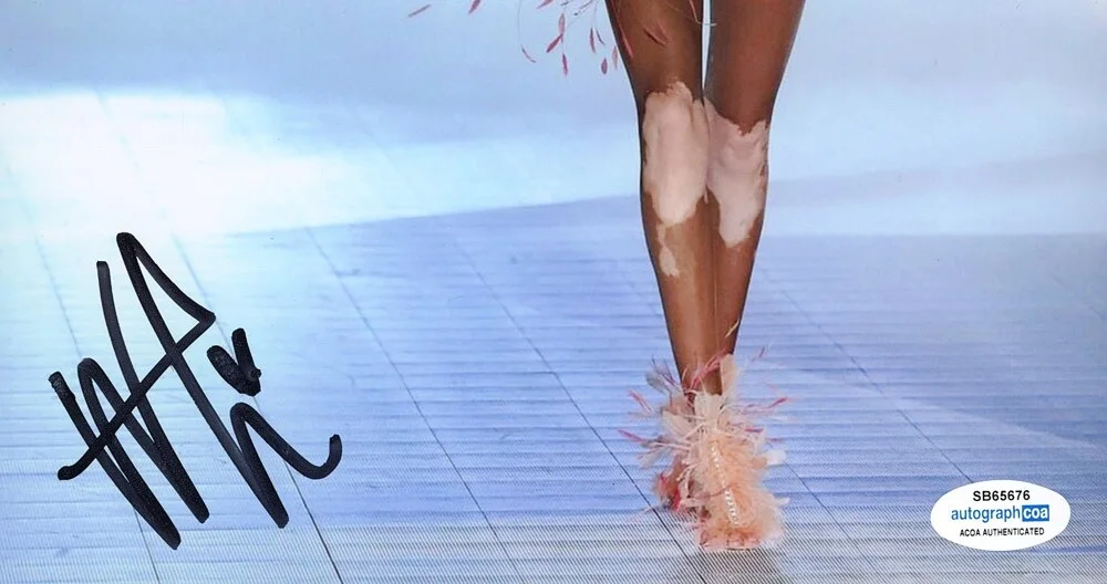 WINNIE HARLOW — Winnie Harlow signed 8x10 Photo "VICTORIA'S SECRET FASHION SHOW" h Sexy ACOA COA, изображение 4