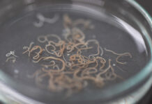 Печеночные сосальщики из сырой рыбы: что такое описторхоз и как им заражаются AscariasisIsADiseaseCausedByTheParasiticRoundwormAscaris