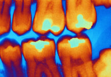 Выбор качественных стоматологических материалов: почему важно доверять профессионалам 6a2acae8-b7f0-494e-9516-89219b3746bd-67c20f5b