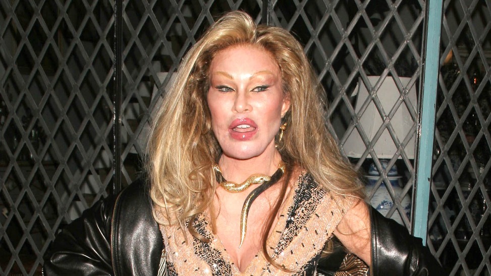 Умерла 84-летняя женщина с «кошачьим» лицом после пластики Джослин Вильденштейн